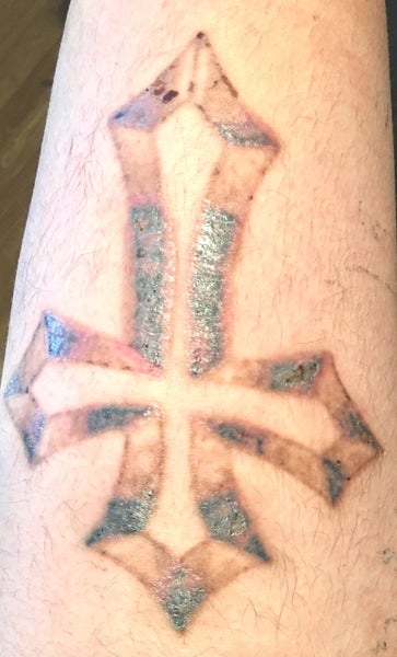 How to Create a Mobile Tattoo Removal Program That Fits Your Budget - Jails  to Jobs