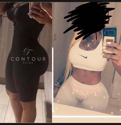 l Lipo Journey Karl William Schwarz Md Review Realself