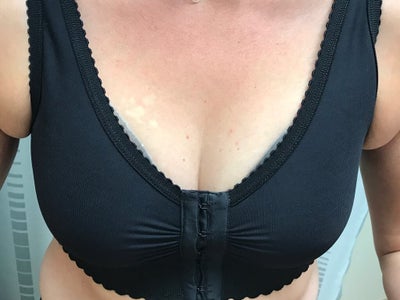 26yrs, No Kids, 5'2 110lbs, B to DD/DDD cup, 485 CC Silicone