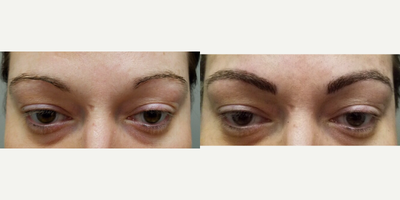 35-44 year old woman treated with Permanent Makeup - MicroBlading Before and After pictures by Dr. Deborah Sillins of Rejuvene Plastic Surgery in Northern Kentucky and Cincinnati.
