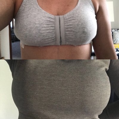Breast reduction 5'3, 36G, size 8 bottoms, hourglass figure - R