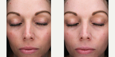 Skinbetter Science - Sunbetter Sheer SPF 56 Sunscreen Stick.Photo provided courtesy of Skinbetter Science.
