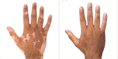 Man treated with Permanent Makeup - Man treated with Permanent Makeup.