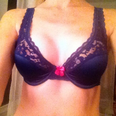 My Boob Journey: 32A to 32C, 300cc - Saint Louis, MO - Review 