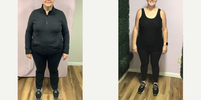 35-44 year old woman treated with Endoscopic Sleeve Gastroplasty - Our patient lost 63 Lbs in 6 months after her Endoscopic Sleeve Gastroplasty.
