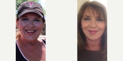 Woman treated with Neck Lift, Brow Lift, Eyelid Surgery, Facial Fat Transfer - Take a look at one of our beautiful faces! This patient had a face/necklift, brow lift, upper/lower blepharoplasty and fat transfer. Pics are 3 weeks post-op.