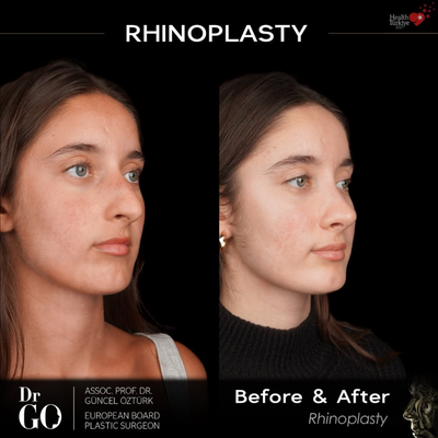 before and after image