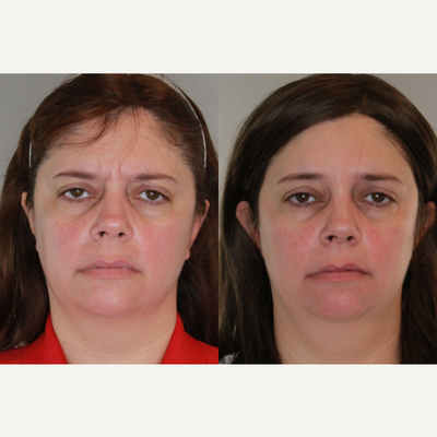 before and after image