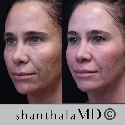 before and after image