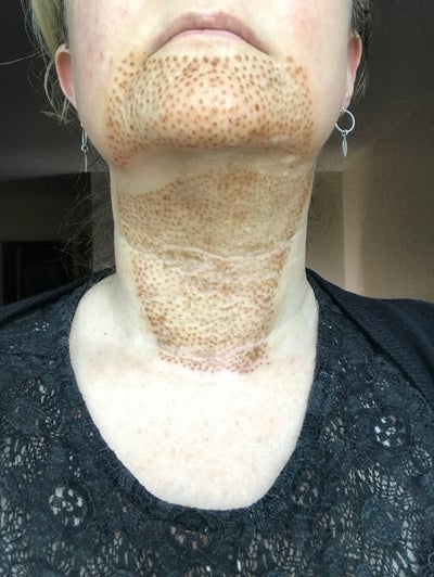 Devastated With Result Review Realself