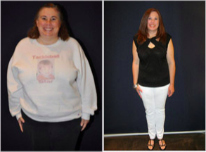 Lap Band - Lost over 122 pounds