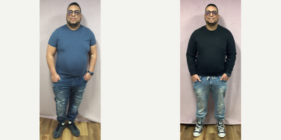 25-34 year old man treated with Endoscopic Sleeve Gastroplasty - The patient had his Endoscopic Sleeve Gastroplasty procedure done by Dr. Batash. He lost 26 Lbs over a month.