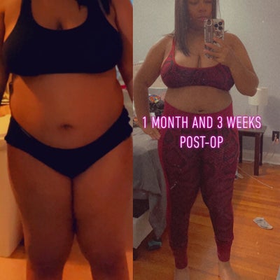 semaglutide with l-carnitine reviews l carnitine for weight lifting Maximize Your Weight Loss Journey with  Semaglutide and L-Carnitine Injections