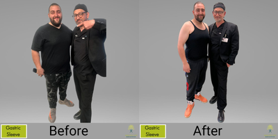 35-44 year old woman treated with Gastric Sleeve Surgery - One step at a time, one pound at a time. Celebrating progress with the #GastricSleeve.