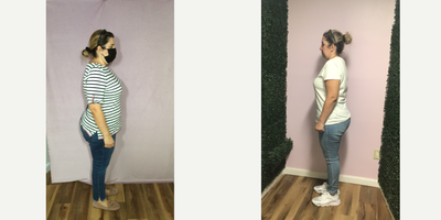 35-44 year old woman treated with Endoscopic Sleeve Gastroplasty - She lost 53 Lbs in 13 months after her Endoscopic Sleeve Gastroplasty procedure.