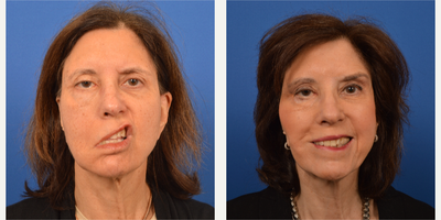 Facial Reconstructive Surgery - Facial Reconstructive Surgery