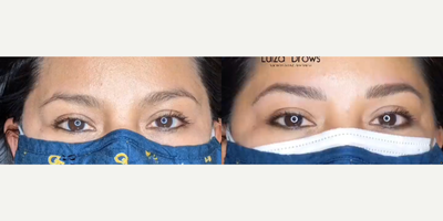 Woman treated with Microblading - Woman treated with Microblading
