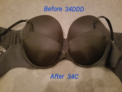33, Mom of 2, Reduction 34DDD to a 34C - Review - RealSelf
