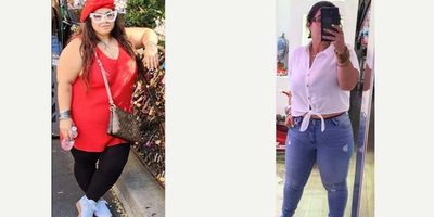 Woman treated with Gastric Sleeve Surgery - 9 months of discipline, perseverance, and commitment.We are going towards a healthier life.