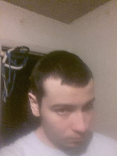 Is my hairline receding more on my right side? (Photo ...