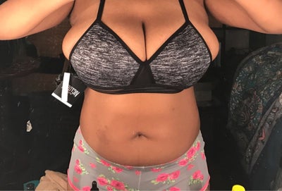 23 Yrs Old, No Kids, 32J Breast Reduction - Review - RealSelf
