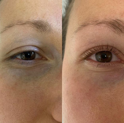 Woman treated with Lash Lift - Woman treated with Lash Lift