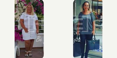 45-54 year old man treated with Gastric Bypass - Lost 39 kgWe are proud of her