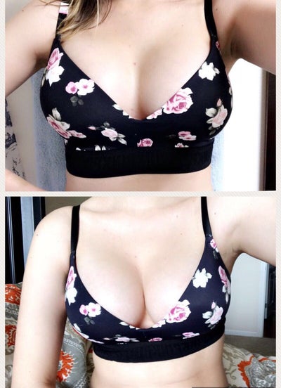 32B to 32DD: getting the boobs I've always dreamt of - Review - R