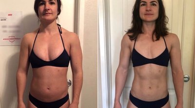 25-34 year old woman treated with truSculpt iD - Our 25 year old patient is in good shape but she was concern about her stubborn belly fat. We used 6 Trusculp ID paddles on her for 15 min.