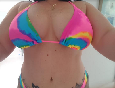 36DD Never Thought I'd Need - Miami, FL - Review - RealSelf