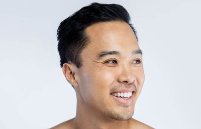 PRP for Hair Loss