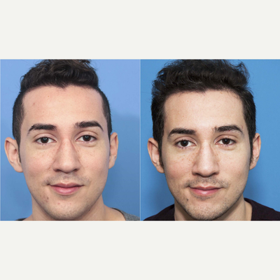 before and after image