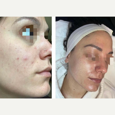 before and after image