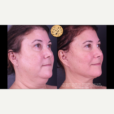 before and after image