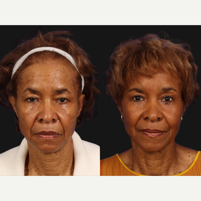 before and after image