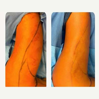 before and after image
