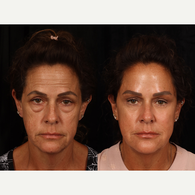 before and after image