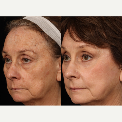 before and after image