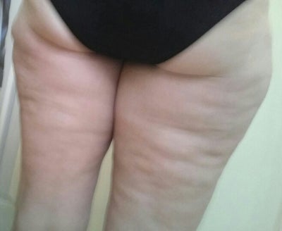 Bodyfx First Reaction And Before Pictures Toronto On Review
