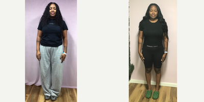25-34 year old woman treated with Orbera Gastric Balloon - She lost 33 LBS in six months after her Orbera (Intra)Gastric Balloon. She feels great mentally and physically.