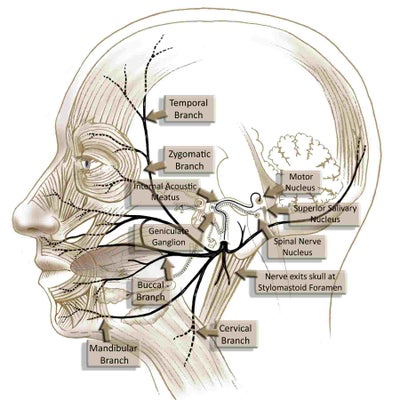 Botox Injection Hit a Nerve? (photo) Doctor Answers, Tips