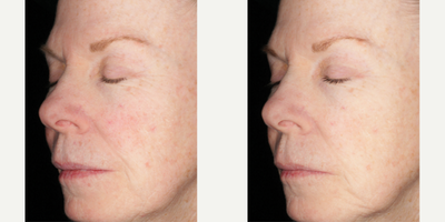 Skinbetter Science - Alto Defense Serum.Photo provided courtesy of Skinbetter Science.