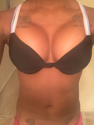 23 Yr Old No Kids 34a 375 400cc Silicone Moderate Plus