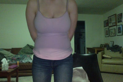 21 Years Old - 32DDD to 32B Breast Reduction - Boulder, CO 