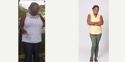 45-54 year old woman treated with Intragastric Balloon - Bayyinah lost 50 lbs since October 2016 with New York Bariatric Group. She was able to achieve her weight-loss goal with the ReShape Gastric Balloon in conjunction with our comprehensive program.