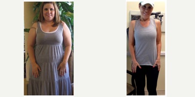 35-44 year old woman treated with Lap Band - Pre-op weight: 212 lbsTotal Weight Loss: 81 lbs