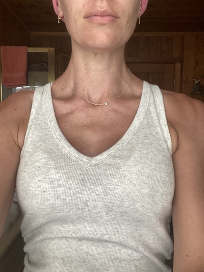 From this (age 43) to THIS (age 45)! 40C and they're still growing. I  always thought I'd need a breast augmentation to have shapenow I'm not  sure I want one. Hormones are