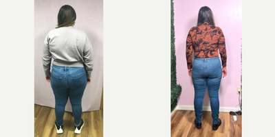 35-44 year old woman treated with Endoscopic Sleeve Gastroplasty - She lost 49 lbs in 11 months after her Endoscopic Sleeve Gastroplasty Procedure