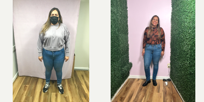 35-44 year old woman treated with Endoscopic Sleeve Gastroplasty - She lost 49 lbs in 11 months after her Endoscopic Sleeve Gastroplasty Procedure
