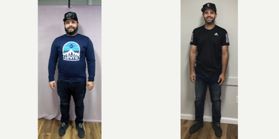 25-34 year old man treated with Endoscopic Sleeve Gastroplasty - The patient had his Endoscopic Sleeve Gastroplasty procedure done by Dr. Batash. He lost 83 Lbs over five months.